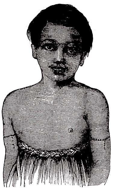 A boy of Ocean Island in the Kingsmill Islands.